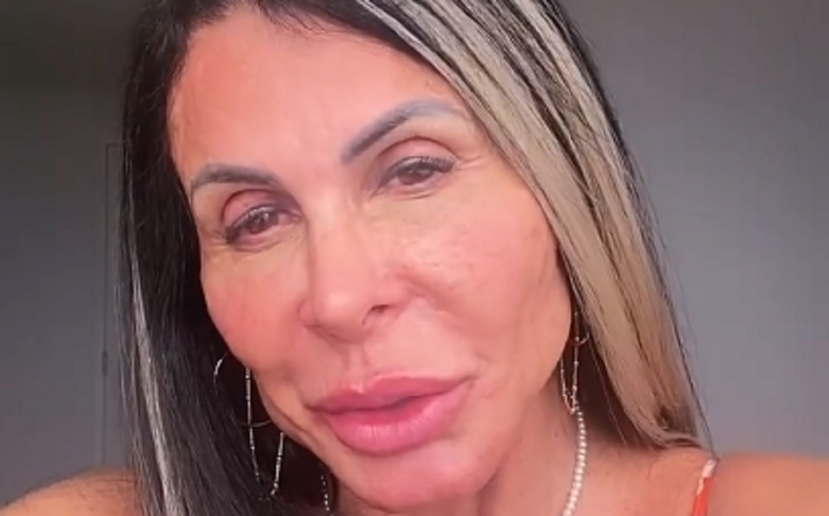 Gretchen após a nova harmonização facial (Foto: Reprodução)