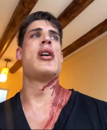 Tiago Ramos surgiu com o corpo todo sujo de sangue (Foto: Reprodução/ Instagram)