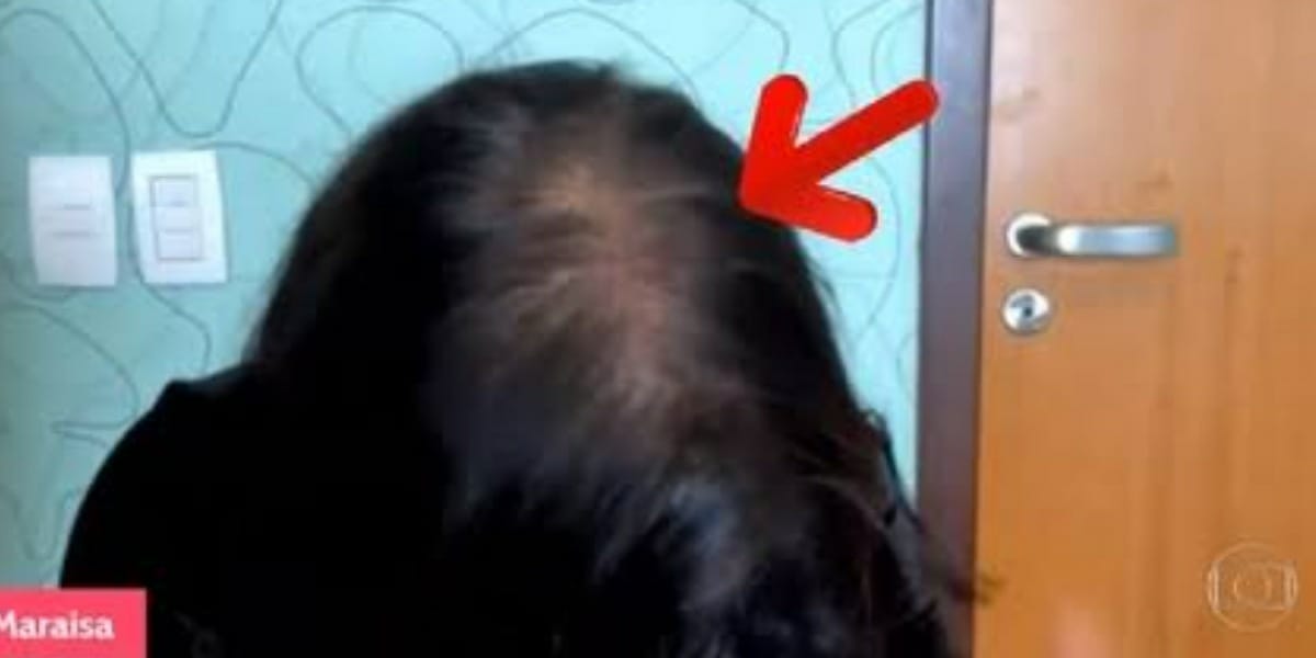 Maraisa, da dupla com Maiara revela ter doença sem cura nas redes sociais e mostra mudança após perda de cabelos no É De Casa - Foto: Reprodução/Globo
