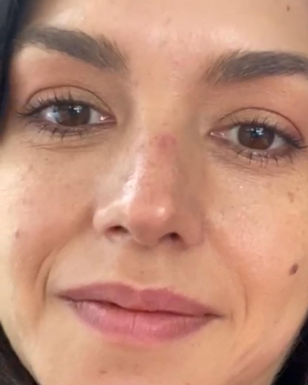 Thais Fersoza exibe machucado em nariz (Reprodução)