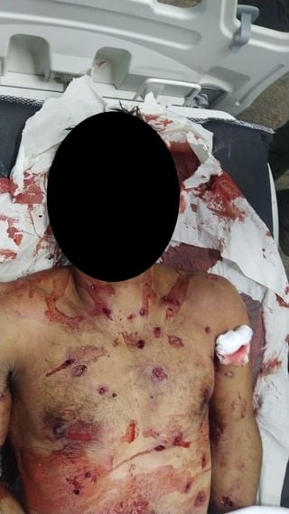Vazou foto do corpo de Lázaro cheio de tiros (Imagem: Reprodução)