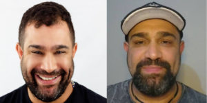Evandro Santo fala sobre vício em drogas (Foto: Reprodução/Instagram)