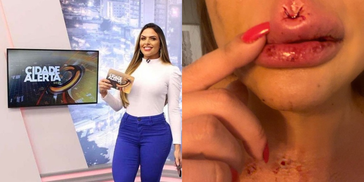 Apresentadora da Record expõe agressão do ex (Foto: Reprodução) Apresentadora da Record expõe agressão do ex (Foto: Reprodução)
