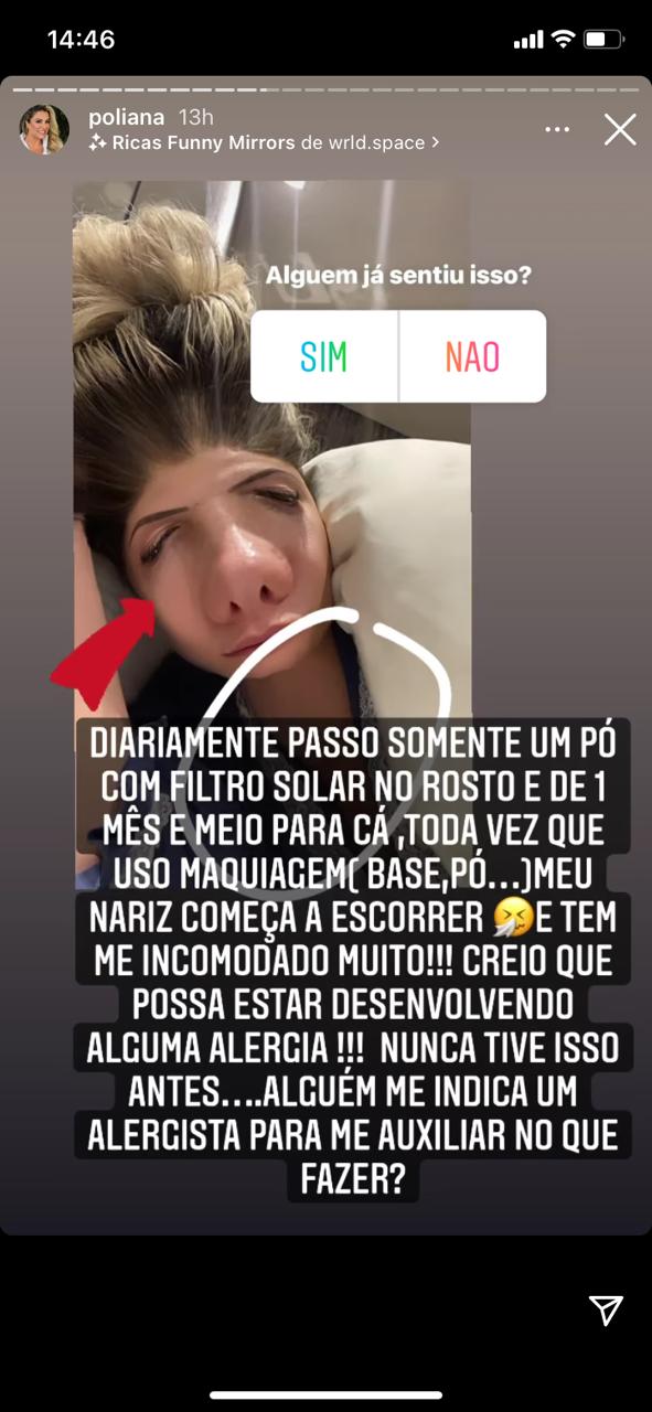 Poliana Rocha surge desfigurada (Reprodução) Poliana Rocha surge desfigurada (Reprodução)