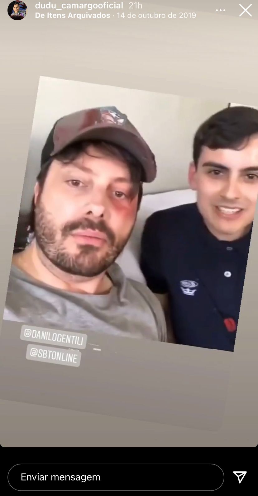 "Olha o que ele fez comigo", Danilo Gentili surge com rosto deformado e confirma que levou surra de Dudu Camargo