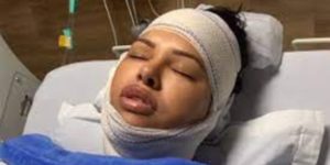 Ariadna fez relato antes e depois da cirurgia (Foto: Reprodução)