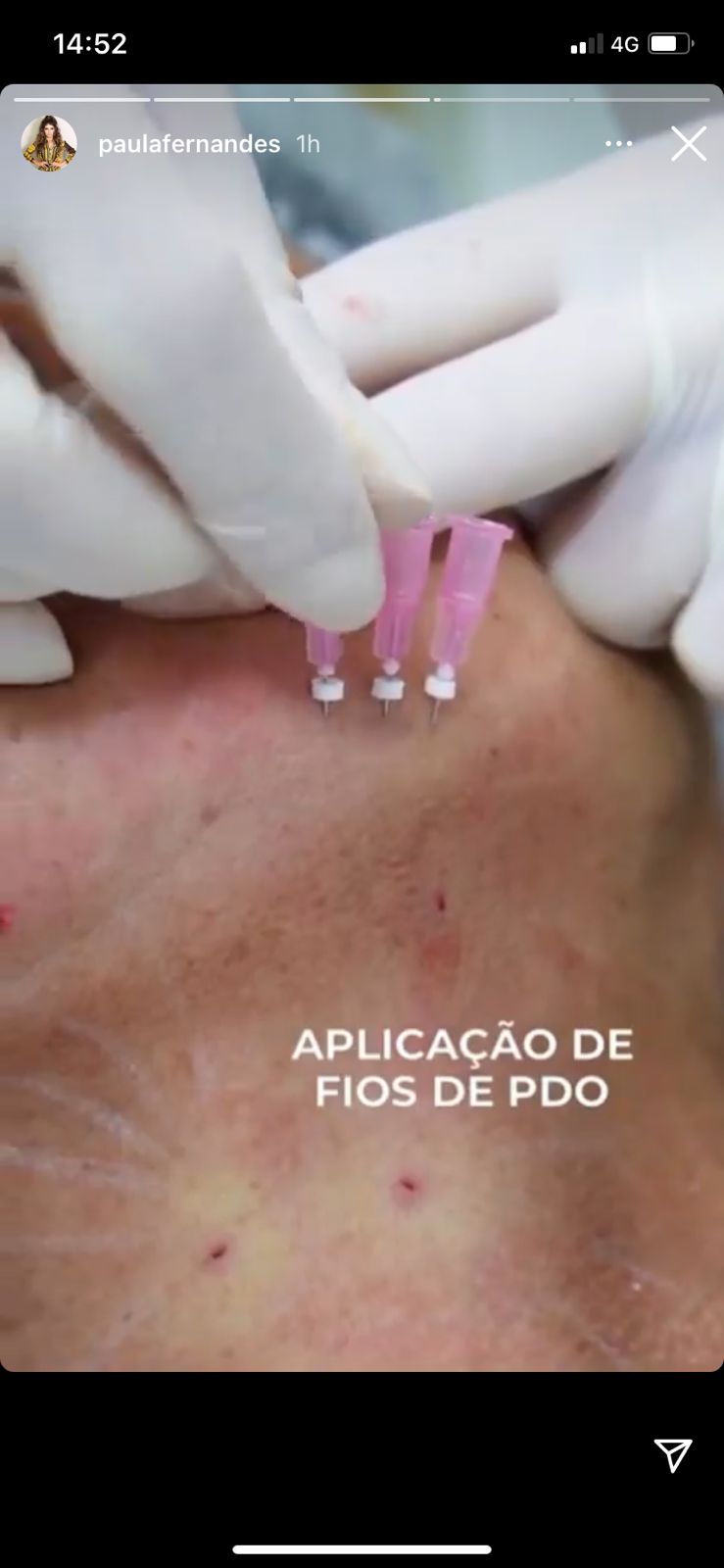 Paula Fernandes expõe mãe em clínica (Reprodução) Paula Fernandes expõe mãe em clínica (Reprodução)
