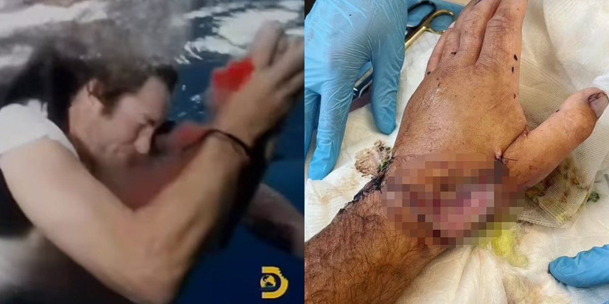 Sean McInerney fore ataque de tubarões durante gravações