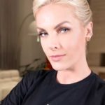 Ana Hickmann sofreu acidente doméstico (Foto: Reprodução) 