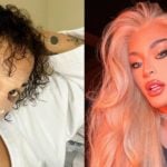 Pabllo Vittar se rendeu a uma cirurgia no nariz (Foto: Reprodução)