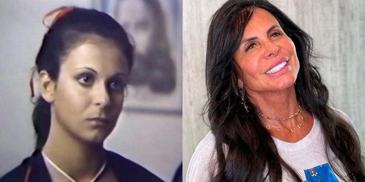 Gretchen antes e depois dos procedimentos estéticos (Foto: Reprodução/Instagram)