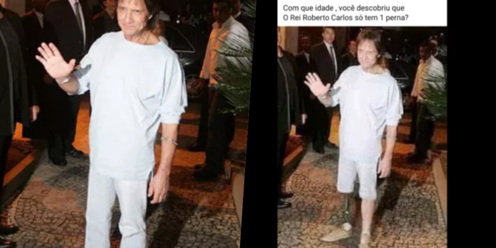 Roberto Carlos teve suposta foto no passado divulgada com prótese na perna direita (Foto montagem: TV Foco) 