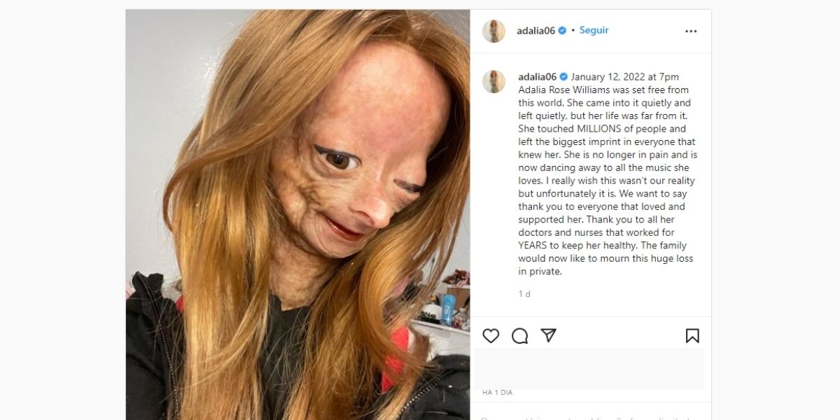 LUTO! Morre grande estrela aos 15 anos por doença incurável e anúncio devasta: "Está livre deste mundo"