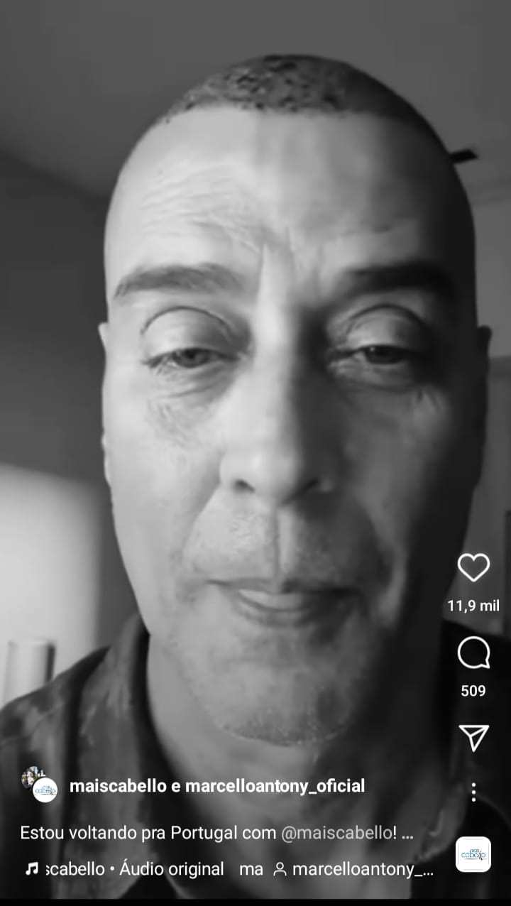 Marcello Antony fez transplante (Foto: reprodução) 