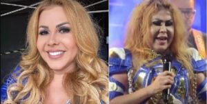 Joelma passou a noite no hospital e recebeu um diagnóstico após surgir completamente inchada- Foto: Montagem/TV Foco