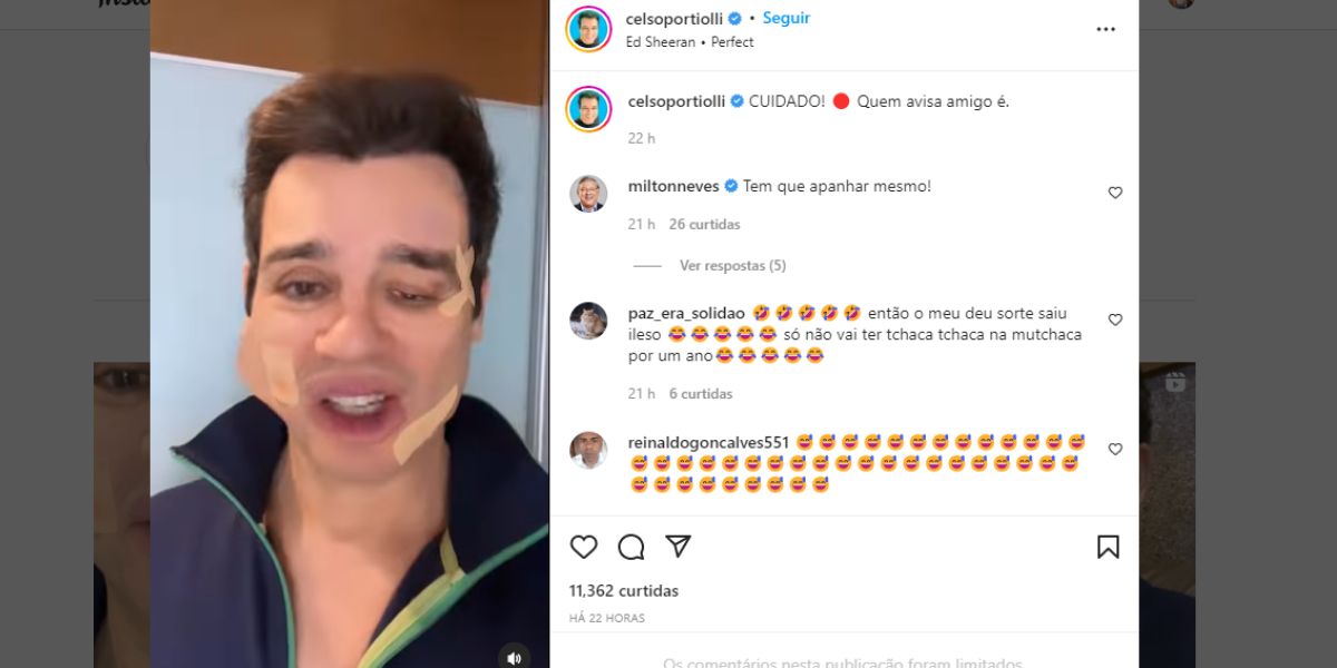 "Cuidado", Celso Portiolli surge com rosto todo deformado em vídeo, expõe surra e motivo: "Nunca esqueça" "Cuidado", Celso Portiolli surge com rosto todo deformado em vídeo, expõe surra e motivo: "Nunca esqueça"