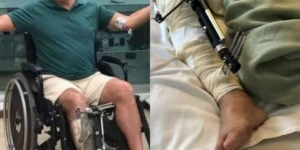 Raymundo de Souza passou por 65 cirurgias (Foto: Reprodução/Instagram)