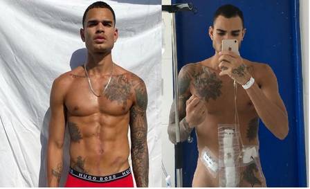 Jonas Piazon antes e depois de ser esfaqueado (Imagem: Montagem)