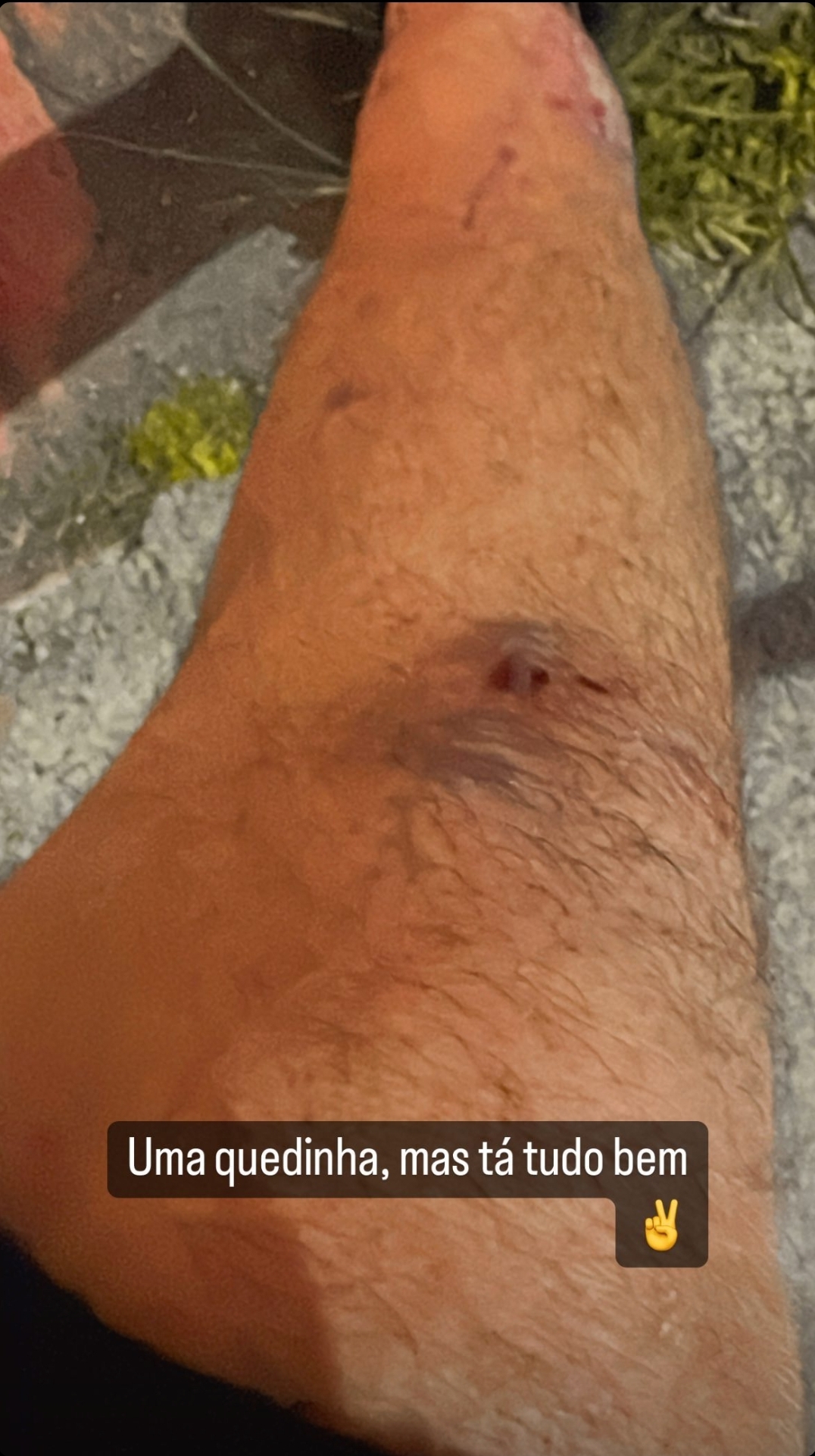 Rodrigo Mussi voltou a ser assunto e dessa vez por conta de um novo acidente (Foto: Reprodução)