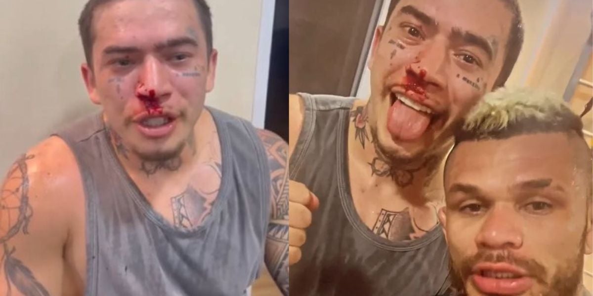 Whindersson Nunes surge com ferimentos e explica que levou a pior durante luta - Reprodução Instagram