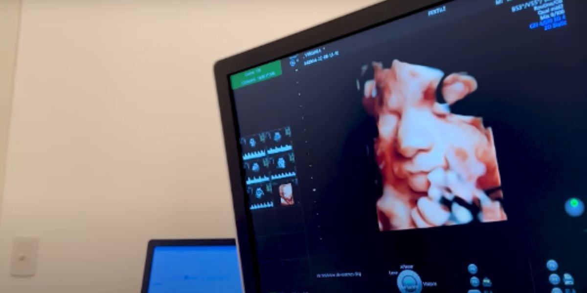 Virgínia Fonseca mostra pela primeira vez o rostinho de sua caçula em ultrassom 3D 