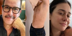 Filho gato de Alessandra Negrini e Murilo Benício surge em foto rara com unhas pintadas e prova que beleza é de família (Foto: Reprodução)