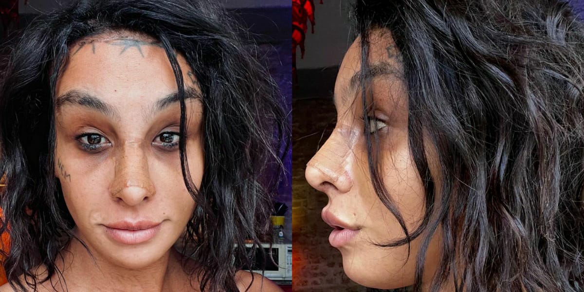 Lina faz cirurgia de feminilização e mostra resultado (Foto: Reprodução)