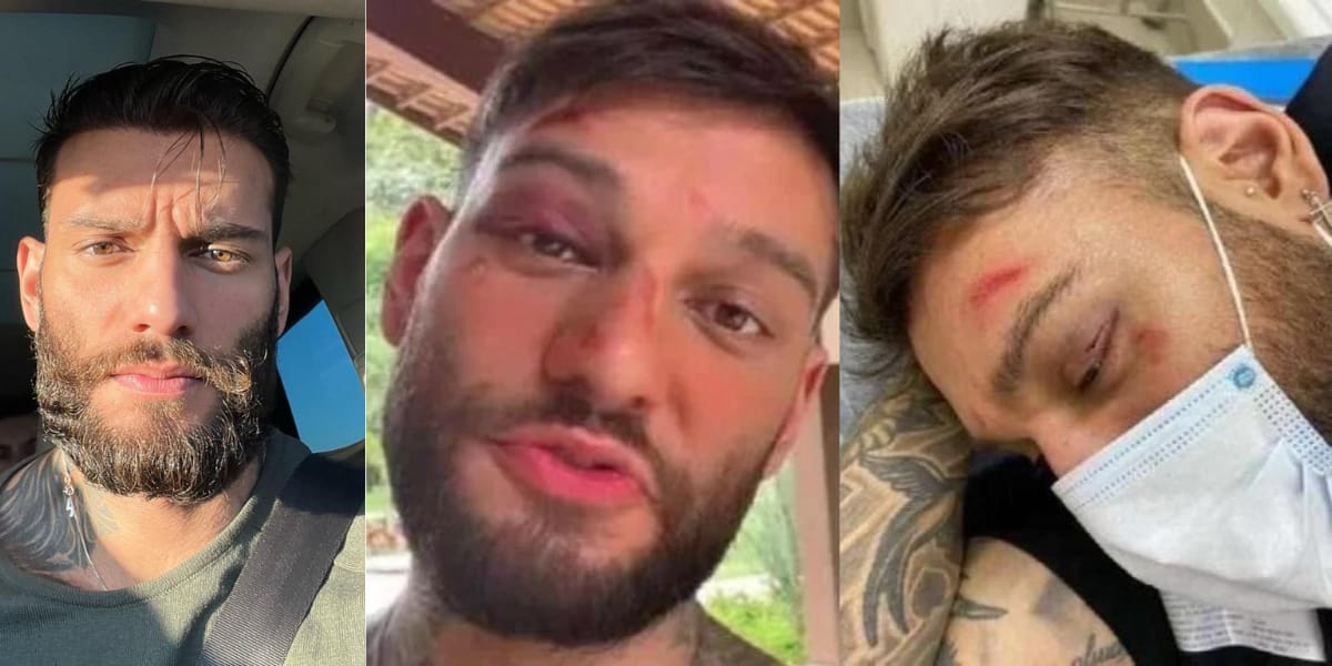 Lucas Lucco sofre acidente doméstico (Reprodução: Montagem TV Foco)
