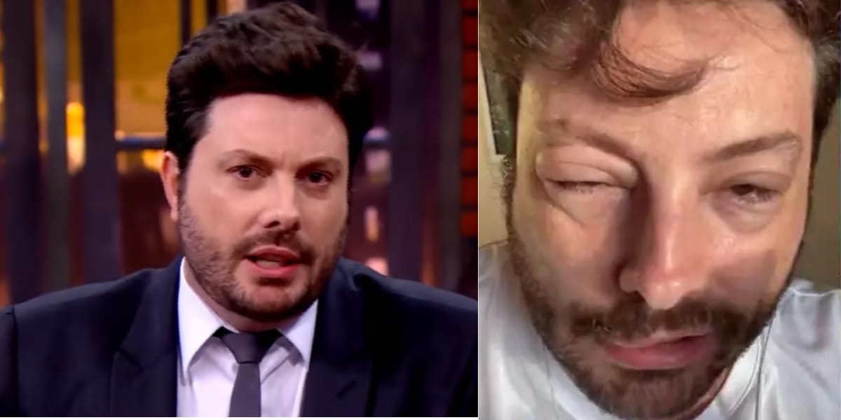 Danilo Gentili sofre com reação alérgica (Reprodução: Montagem TV Foco)