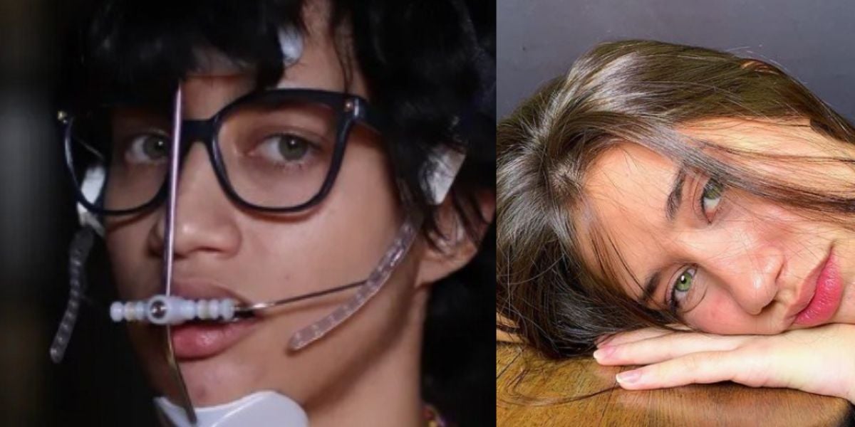 Atriz da Globo impressiona com beleza absurda