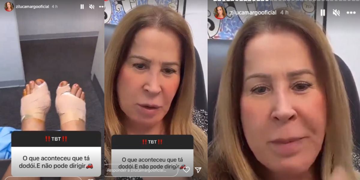 Zilu aparece com os dois pés operados: 'Estou sumida para cuidar da saúde'