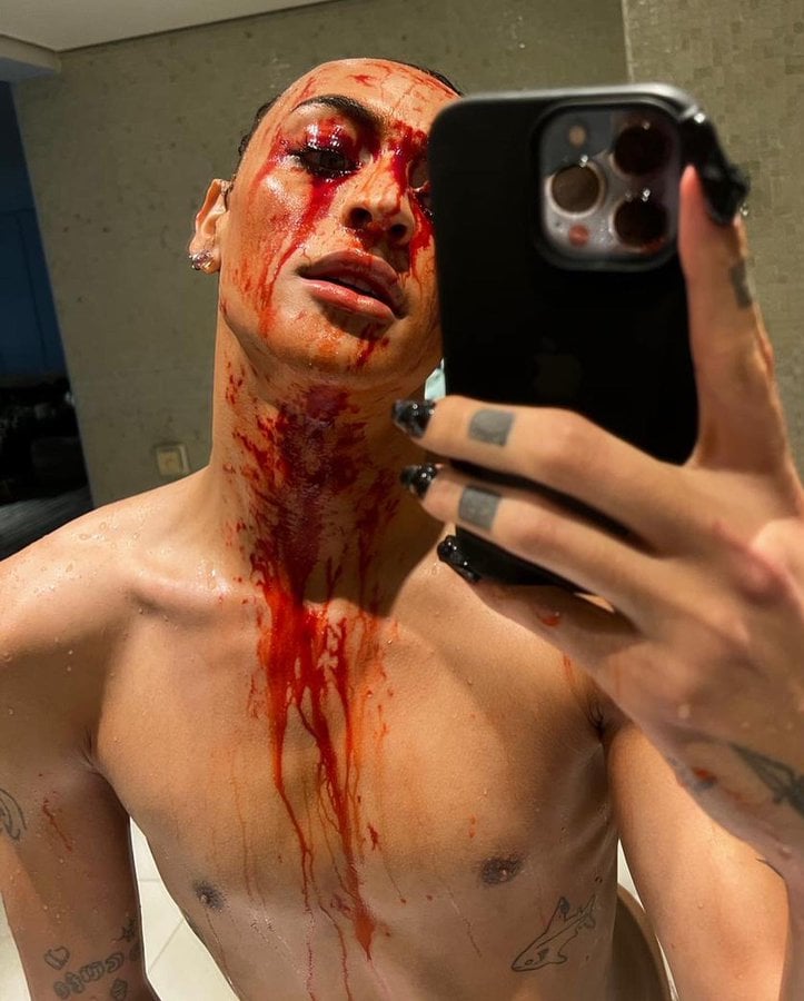 Pabllo Vittar surgiu ensaguentada e contou preocupação da mãe (Foto: Reprodução)