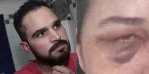 Ex de Luciano Camargo é espancada com capacete e presa durante briga generalizada: ‘Posso ficar cega’ - Reprodução