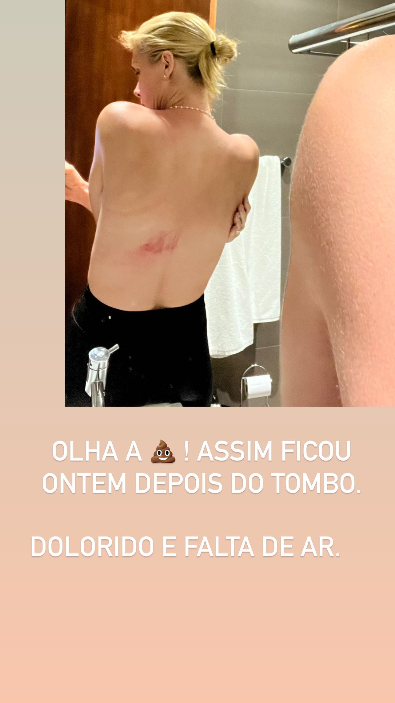 Ana Hickmann se machucou feio ao descer de cavalo (Foto: Reprodução)