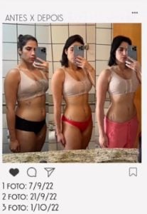 Jéssica Beatriz em foto do Instagram; filha de Leonardo mostrou detalhes do antes e depois (Foto: Reprodução / Instagram)