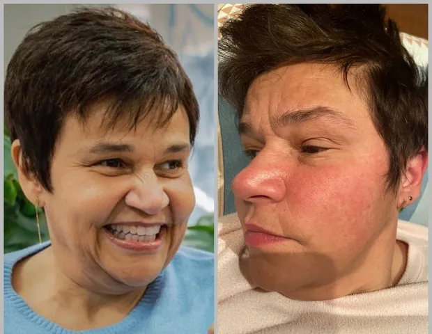 Manchas de Claudia Rodrigues deixaram os médicos preocupados (Foto: Reprodução)