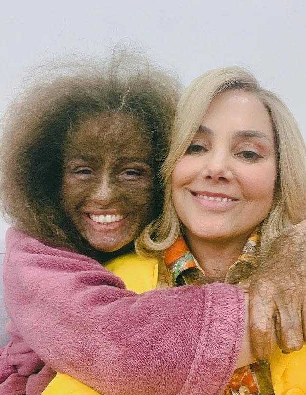 Nanda Costa surge em foto completamente peluda e choca a todos
