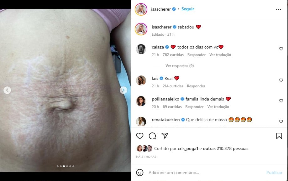 Isa Scherer, filha do nadador Xuxa, mostra barriga real um mês após o parto dos gêmeos - Foto: Reprodução