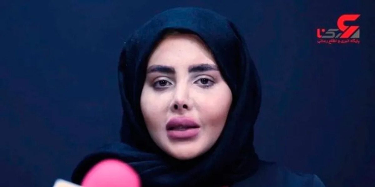 A verdadeira face de Sahar Tabar, mundialmente conhecida por "Angelina Jolie Zumbi" (Foto Reprodução/Internet)