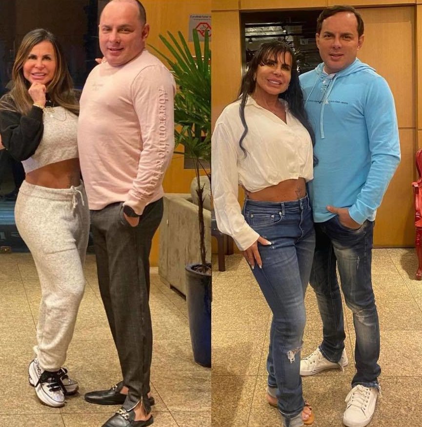 Marido de Gretchen mostra procedimentos e choca com resultado