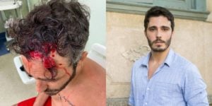 Thiago Rodrigues foi espancado em assalto (Reprodução)