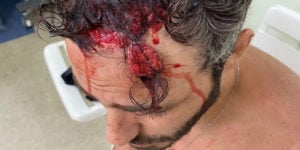 Imagem PreCarregada