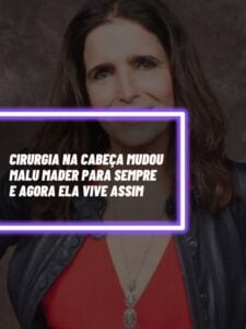 Cirurgia na cabeça mudou a vida de Malu Mader para sempre (Foto - Montagem TV Foco).