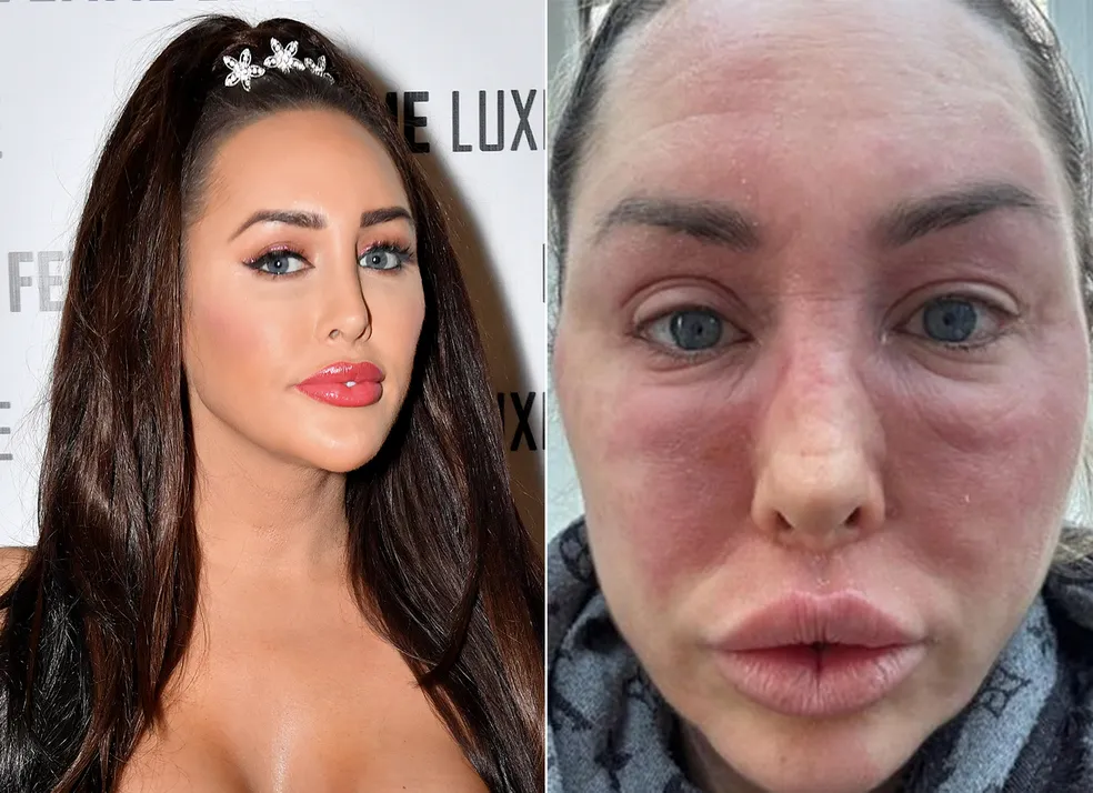 Desfigurada, estrela de reality é hospitalizada às pressas - Foto Reprodução