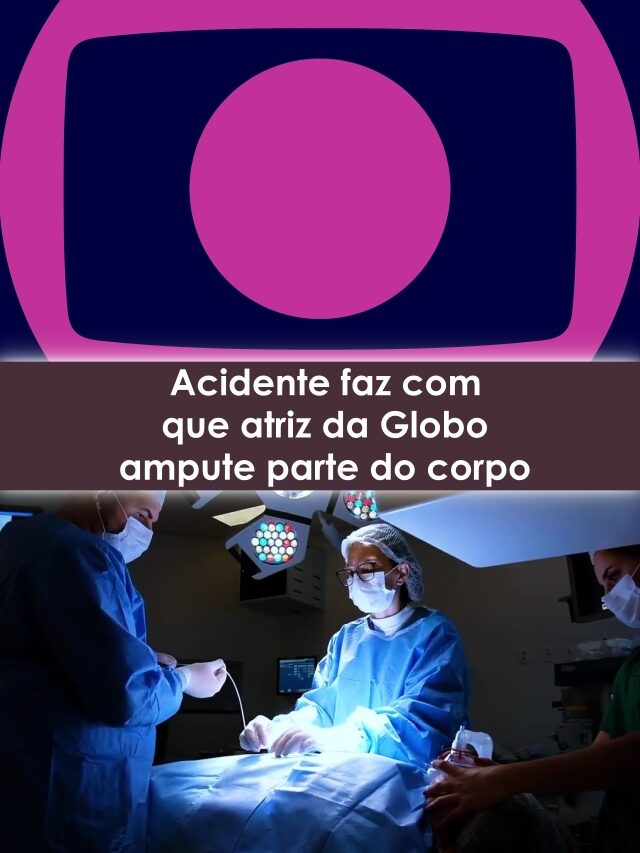 Acidente faz com que atriz da Globo ampute parte do corpo
