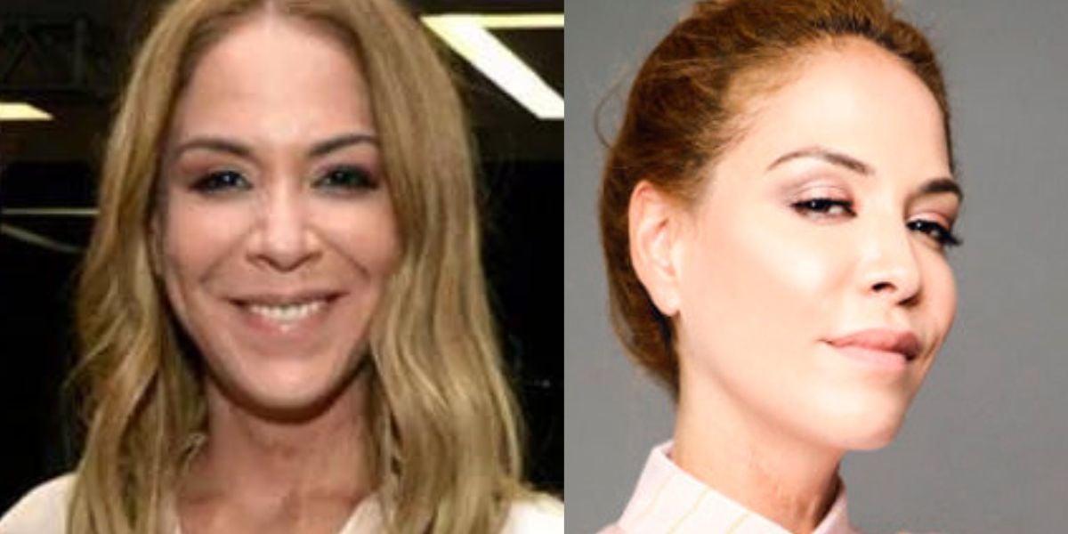 Julia Almeida, a Estela de Laços de Família, descobriu doença e vive fora do país (Fotos: Reprodução / Instagram / Cristina Granato )