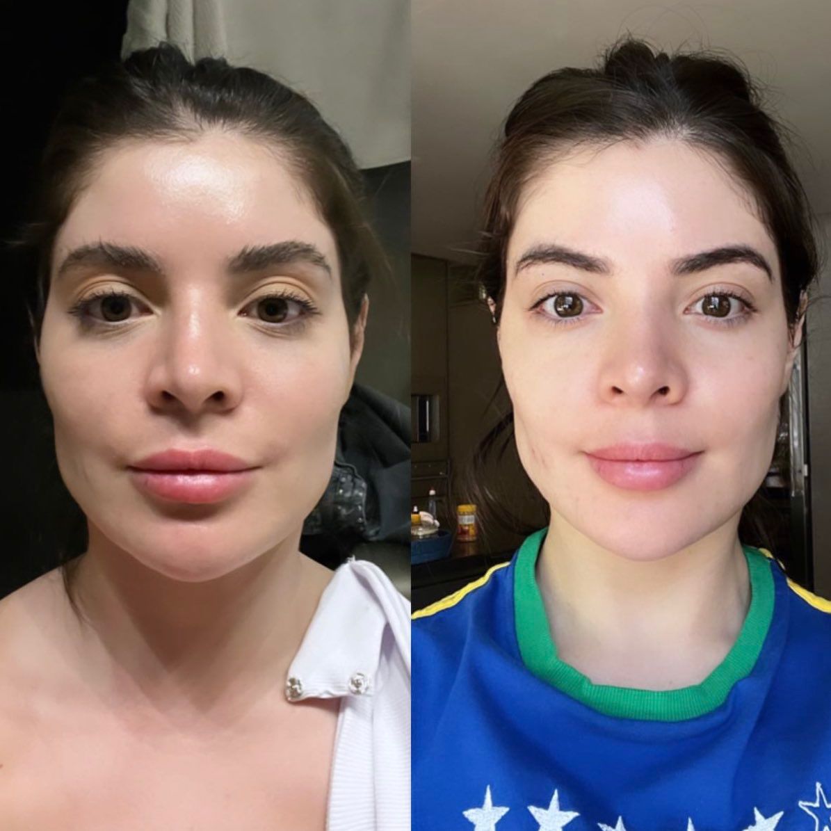 Gkay mostrou nas redes sociais como está após as mudanças de retirada das harmonizações (Reprodução - Instagram)