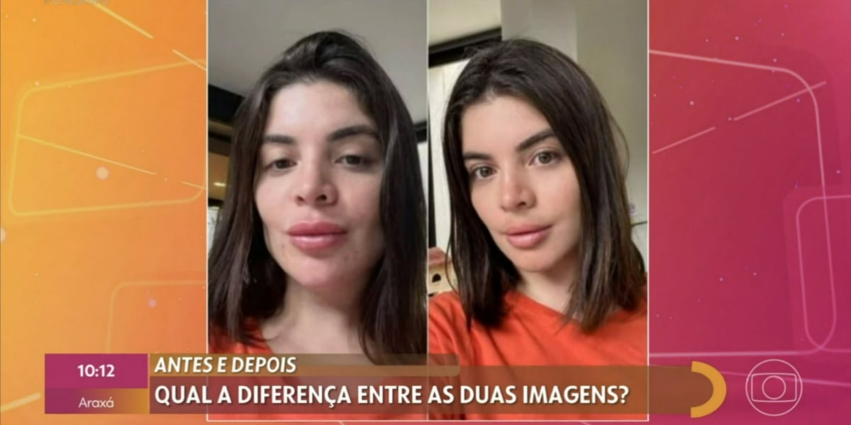 Procedimentos estéticos de GKay viraram notícia no "Encontro" (Foto: Reprodução/TV Globo)