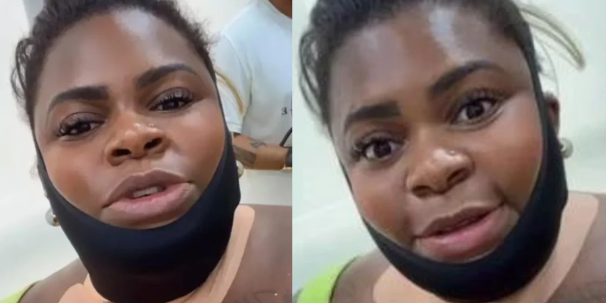 Jojo Todynho surgiu com o rosto enfaixado, mas tranquilizou os fãs ao explicar o motivo (Foto: Instagram)