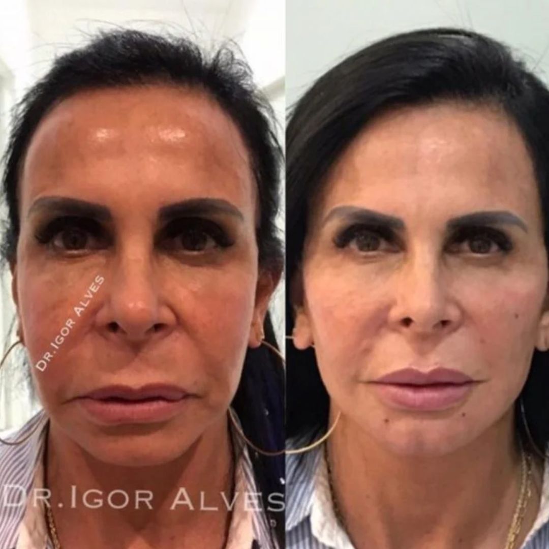 Gretchen surpreendeu os fãs ao aparecer 20 anos mais nova (Reprodução/Instagram)